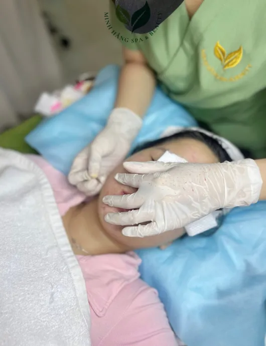 Chăm sóc da mụn cơ bản